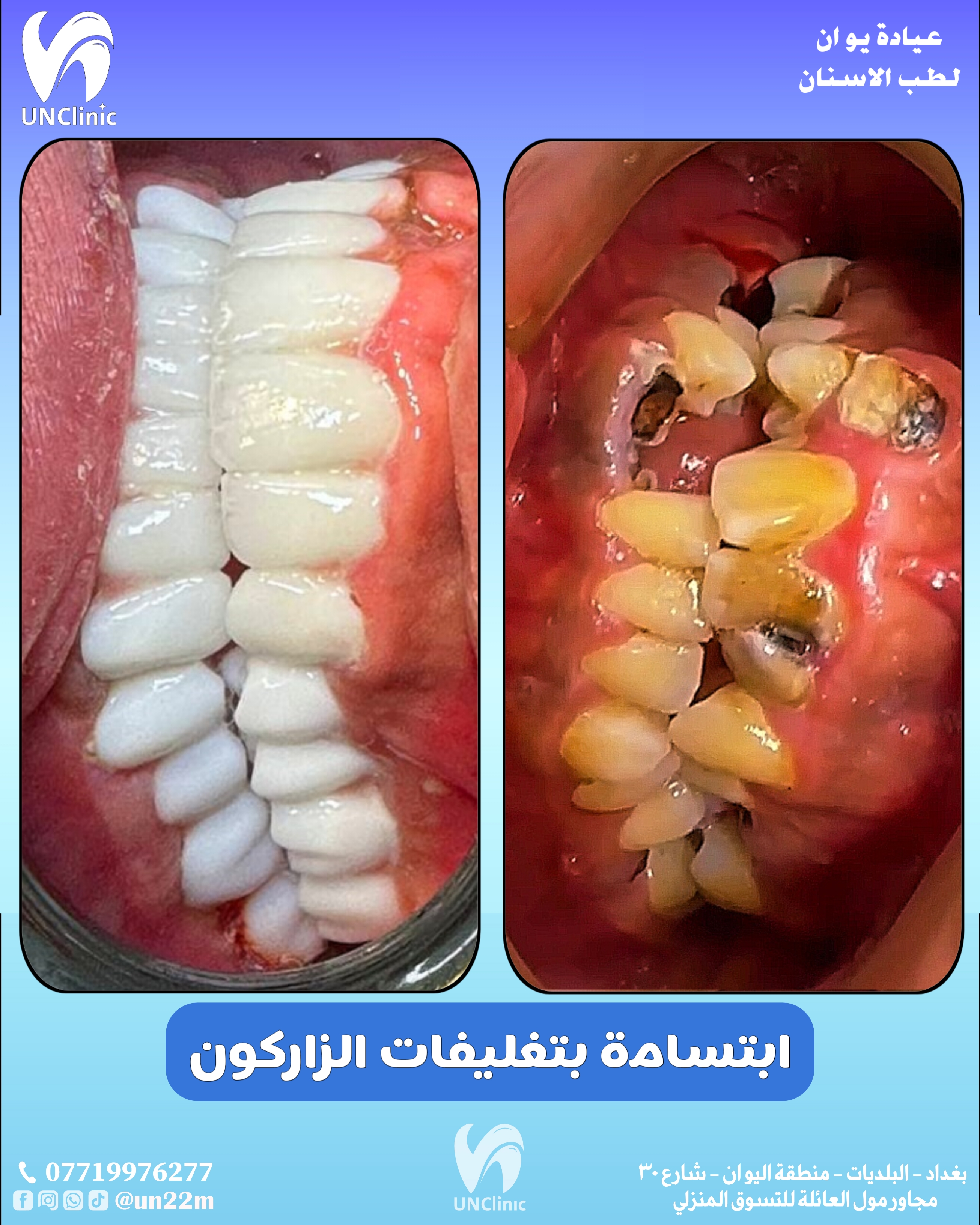 عملية تجميل