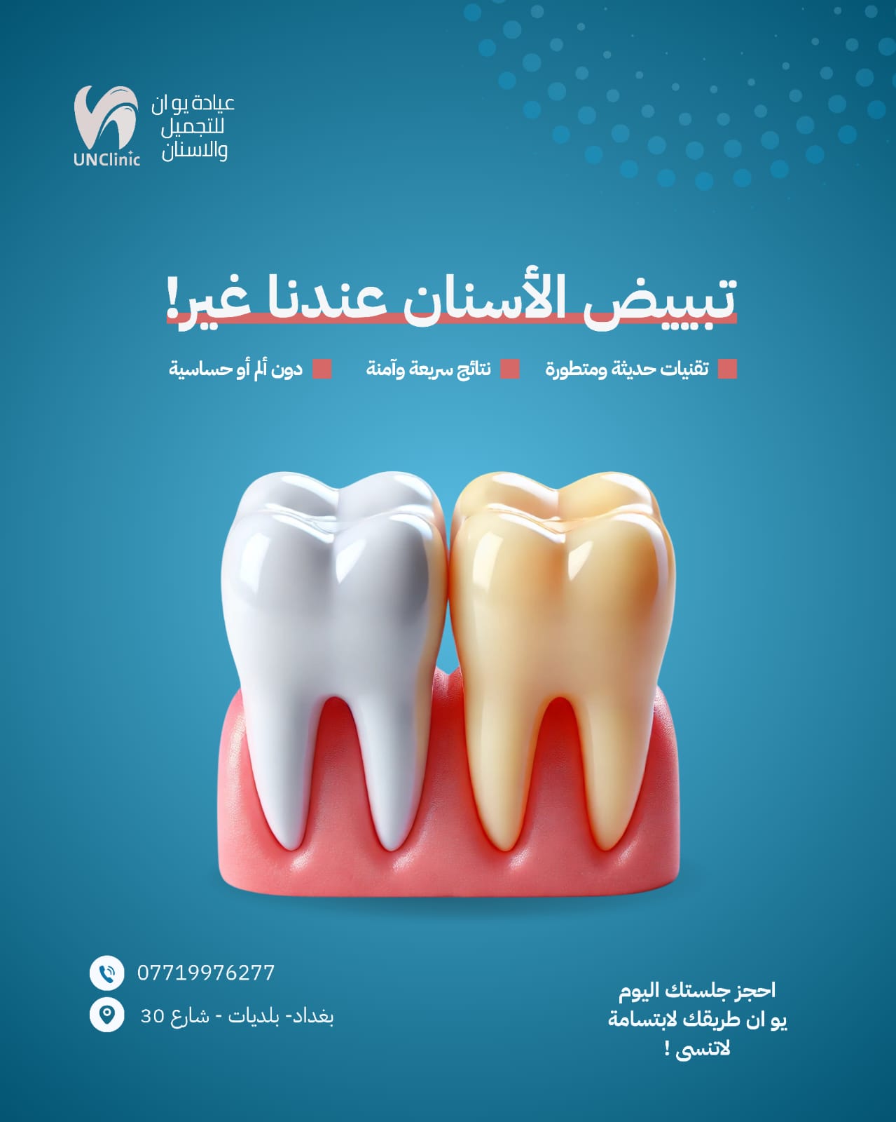 تبييض الأسنان